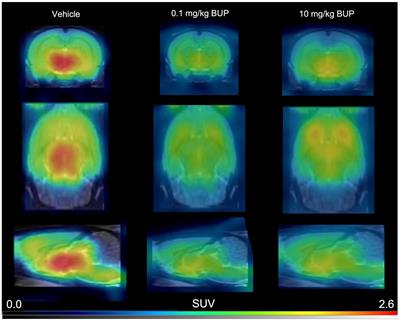 Validation of a pharmacological imaging challenge using 11C-buprenorphine and 18F-2-fluoro-2-deoxy-D-glucose positron emission tomography to study the effects of buprenorphine to the rat brain